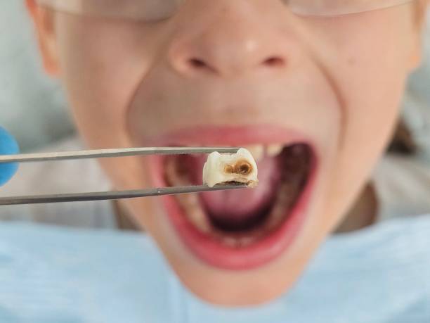 Best Emergency Dental Services for Seniors in Plano, TX